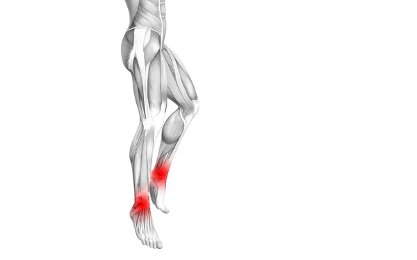 概念的な足首赤ホット スポット炎症や脚医療療法やスポーツ筋概念の関節の関節痛と人間の解剖学 イラストの人関節炎や骨骨粗鬆症病 — ストック写真