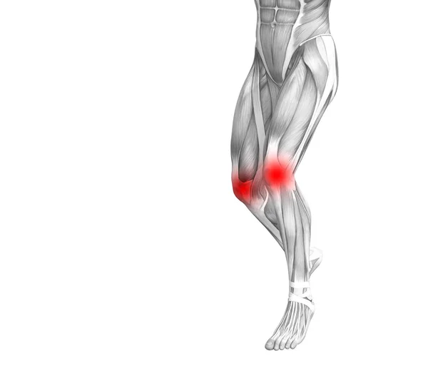 Conceptual Knee Human Anatomy Red Hot Spot Inflammation Articular Joint — Stock Photo, Image