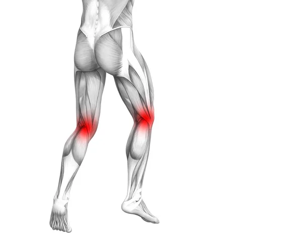 赤のホット スポットの炎症や足医療療法やスポーツ筋概念の関節の関節痛と概念的な膝人体解剖学 イラストの人関節炎や骨骨粗鬆症病 — ストック写真