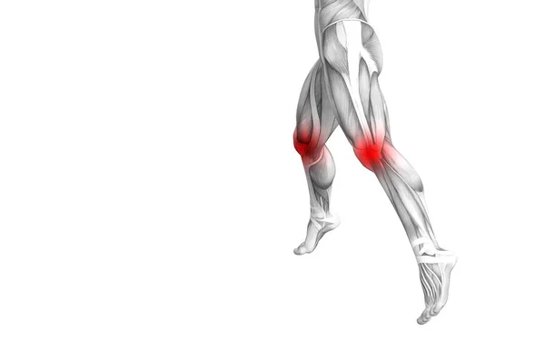概念性膝关节人体解剖学与红色热点炎症或关节关节疼痛的腿保健治疗或运动肌肉的概念 图示人关节炎或骨质疏松症 — 图库照片