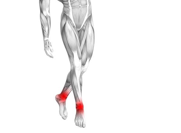 Anatomia Humana Tornozelo Conceitual Com Inflamação Ponto Quente Vermelho Dor — Fotografia de Stock