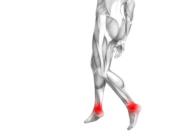 Anatomia Człowieka Pojęciowy Kostki Red Hot Spot Zapalenie Lub Stawowej — Zdjęcie stockowe