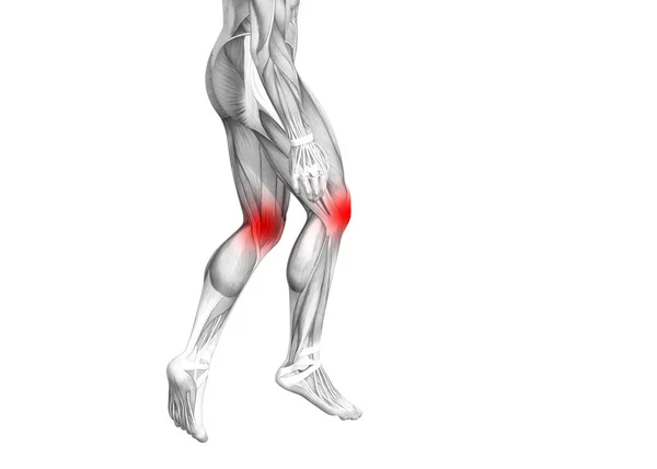 Conceptuele Knie Anatomie Met Rode Hotspot Ontsteking Articulaire Gewrichtspijn Voor — Stockfoto