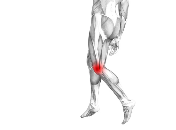 Conceptuele Knie Anatomie Met Rode Hotspot Ontsteking Articulaire Gewrichtspijn Voor — Stockfoto