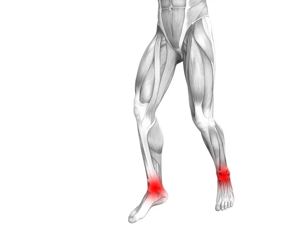 Εννοιολογική Αστράγαλο Ανθρώπινη Ανατομία Φλεγμονή Κόκκινο Καυτό Σημείο Αρθρικός Πόνος — Φωτογραφία Αρχείου