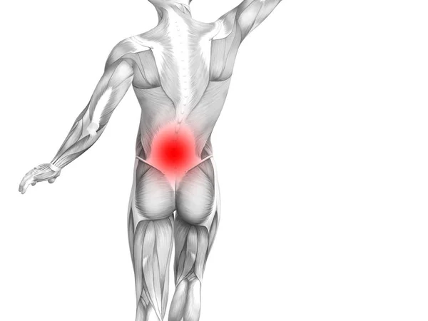 概念背部人体解剖学与红色热点炎症关节关节疼痛或脊柱保健治疗或运动肌肉的概念 图示人关节炎或骨质疏松症 — 图库照片
