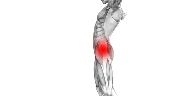 Kavramsal Hip Insan Anatomisi Kırmızı Sıcak Nokta Inflamasyon Eklem Eklem — Stok fotoğraf