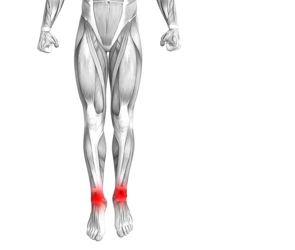Концептуальна Анатомія Щиколотки Людини Запаленням Червоної Гарячої Точки Або Суглобовим — стокове фото