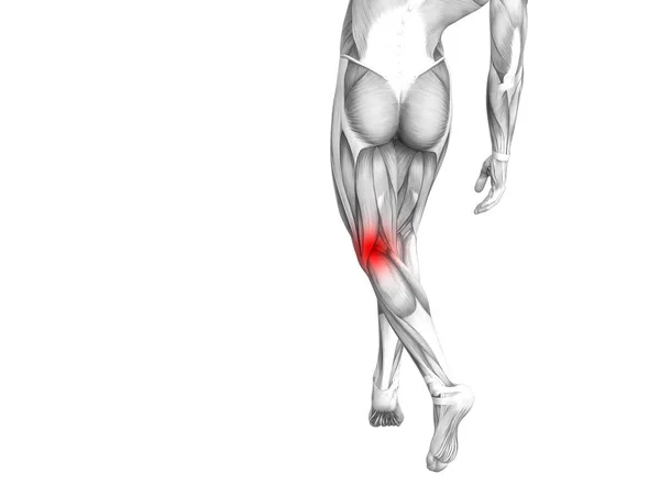 Anatomie Van Het Conceptuele Knie Met Rode Hotspot Ontsteking Articulaire — Stockfoto