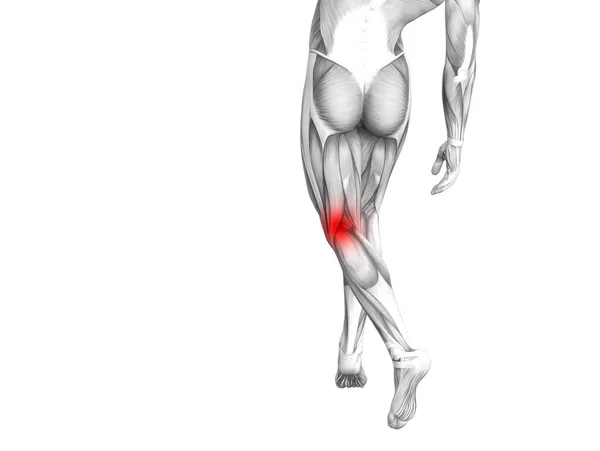 Концептуальная Анатомия Колена Человека Воспалением Красной Горячей Точки Суставной Боли — стоковое фото
