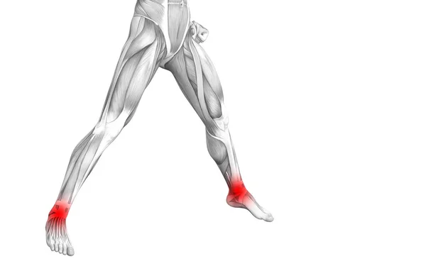 概念脚踝人体解剖学与红色热点炎症或关节关节疼痛的腿保健治疗或运动肌肉的概念 图示人关节炎或骨质疏松症 — 图库照片