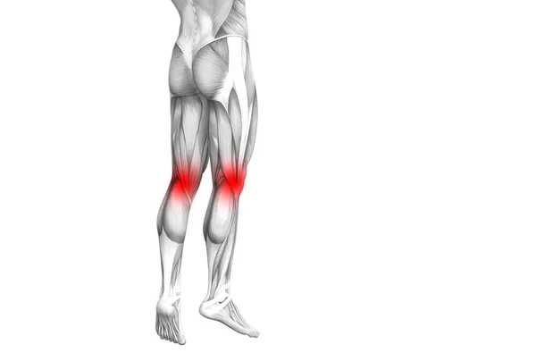 概念膝盖人体解剖学与红色热点炎症或关节疼痛的腿部保健治疗或运动肌肉的概念 说明人关节炎或骨骨质疏松症 — 图库照片