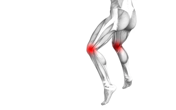 Konzeptionelle Knie Menschliche Anatomie Mit Roten Brennpunkten Entzündungen Oder Gelenkschmerzen — Stockfoto