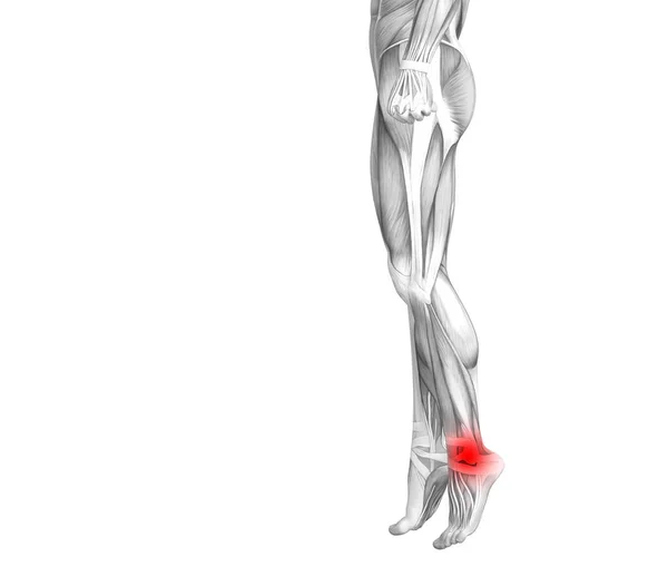 Anatomie Conceptuelle Cheville Humaine Avec Inflammation Des Points Chauds Rouges — Photo