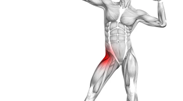 赤ホット スポット炎症関節関節痛足医療療法またはスポーツ筋概念と概念ヒップ人体解剖 イラスト人関節炎や骨痛骨粗鬆症病 — ストック写真