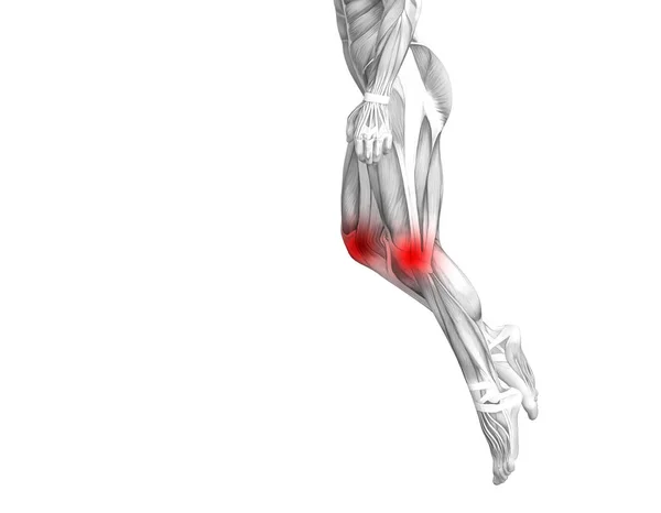 Anatomie Van Het Conceptuele Knie Met Rode Hotspot Ontsteking Articulaire — Stockfoto