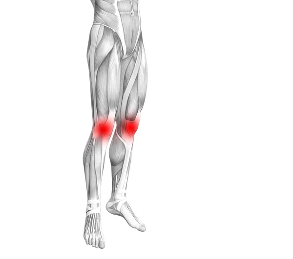 Conceptuele Knie Anatomie Met Rode Hotspot Ontsteking Articulaire Gewrichtspijn Voor — Stockfoto