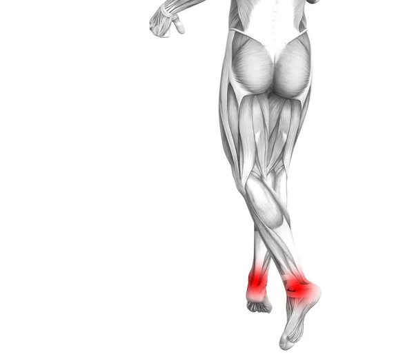 Anatomia Człowieka Pojęciowy Kostki Red Hot Spot Zapalenie Lub Stawowej — Zdjęcie stockowe