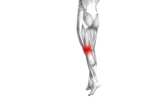 Conceptuele Knie Anatomie Met Rode Hotspot Ontsteking Articulaire Gewrichtspijn Voor — Stockfoto
