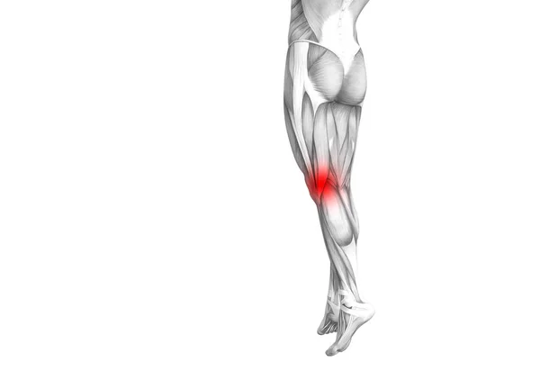 赤のホット スポットの炎症や足医療療法やスポーツ筋概念の関節の関節痛と概念的な膝人体解剖学 イラストの人関節炎や骨骨粗鬆症病 — ストック写真