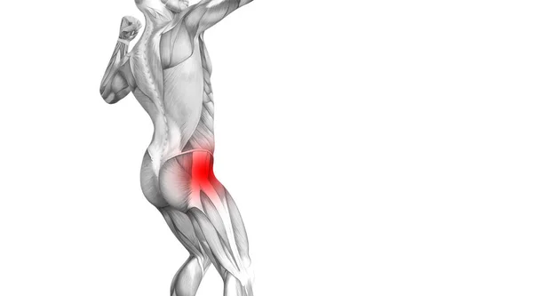 Conceptual Hip Human Anatomy Red Hot Spot Inflammation Articular Joint — Stock Photo, Image