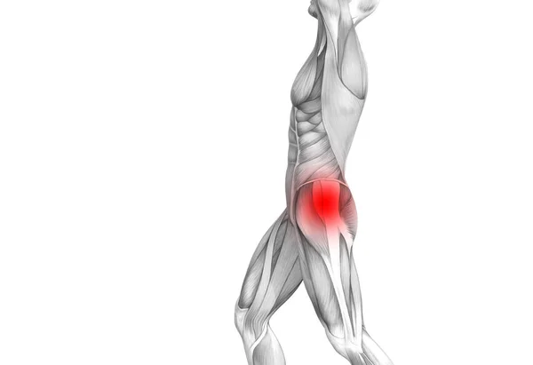 Anatomia Humana Quadril Conceitual Com Inflamação Ponto Quente Vermelho Dor — Fotografia de Stock