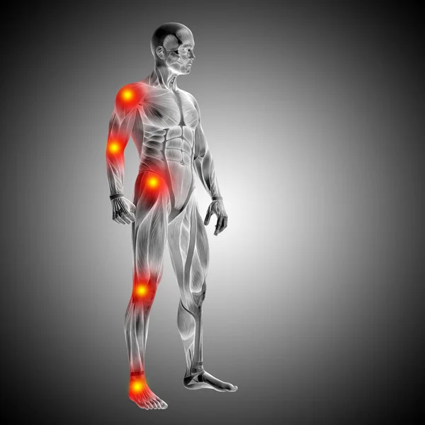 Nsan Anatomisi Vücut Ağrı Enflamasyon Gradyan Arka Planı Gri Ile — Stok fotoğraf