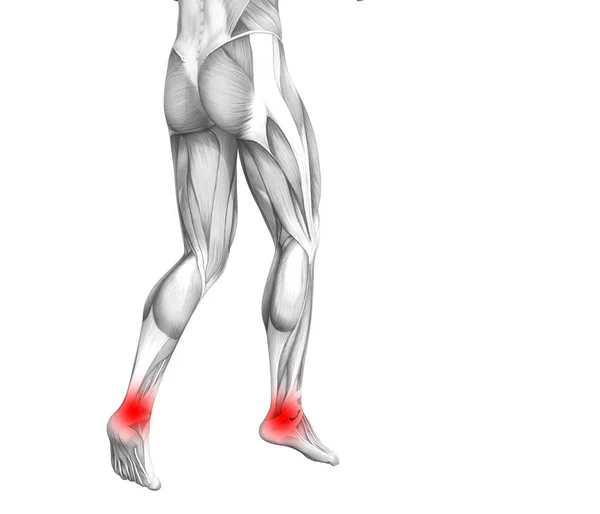 Концептуальная Анатомия Лодыжки Человека Воспалением Красной Горячей Точки Суставной Болью — стоковое фото