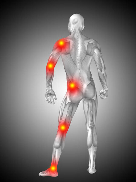Концептуальная трехмерная иллюстрация тела человека с болью и воспалением, серым градиентным фоном
