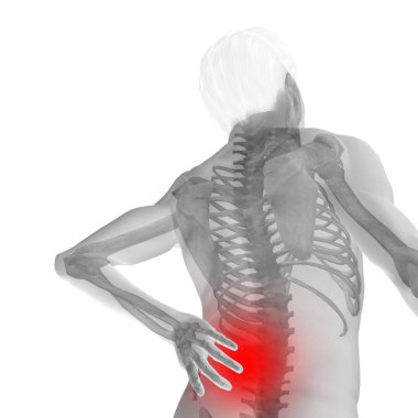 Yüksek çözünürlüklü kavram ya da kavramsal 3d insan erkek veya adam anatomisi bel ağrısı beyaz arka plan üzerinde izole ile