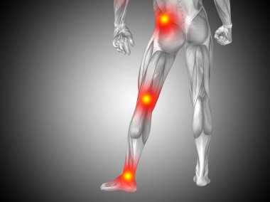 İnsan anatomisi alt beden veya sağlık tasarım, ortak ya da eklem ağrısı, ağrı ya da yaralanma gri degrade arka plan üzerinde kavramsal 3d çizimi