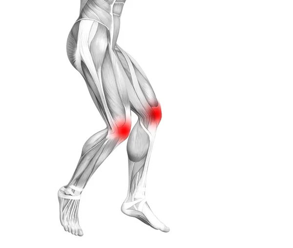 概念性膝关节人体解剖学与红色热点炎症或关节关节疼痛的腿保健治疗或运动肌肉的概念 图示人关节炎或骨质疏松症 — 图库照片