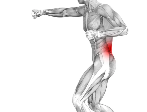 赤ホット スポット炎症関節関節痛や脊椎医療療法やスポーツ筋概念と概念の戻って人間の解剖学 イラスト人関節炎や骨痛骨粗鬆症病 — ストック写真