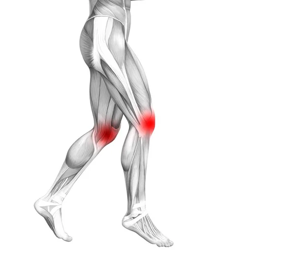 Conceptuele Knie Anatomie Met Rode Hotspot Ontsteking Articulaire Gewrichtspijn Voor — Stockfoto