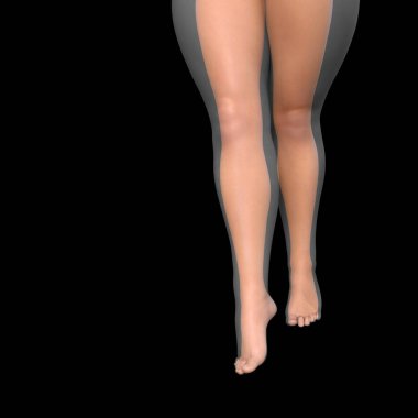 Kavram ya da kavramsal şişman kilolu vs ince kas genç kadın bacakları ile diyet uygun