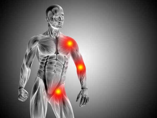 Концептуальный дизайн анатомии человека, боли в суставах или суставах, боль или травма на сером градиентном фоне
.