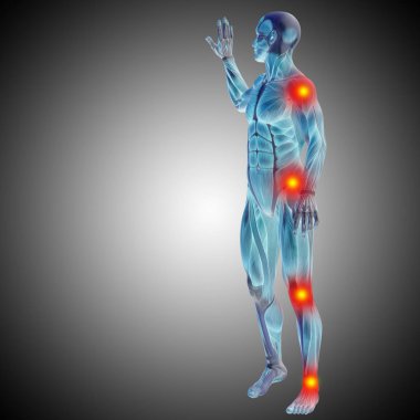 İnsan anatomisi vücut ağrı ve enflamasyon, gradyan arka planı gri ile kavramsal 3d çizimi