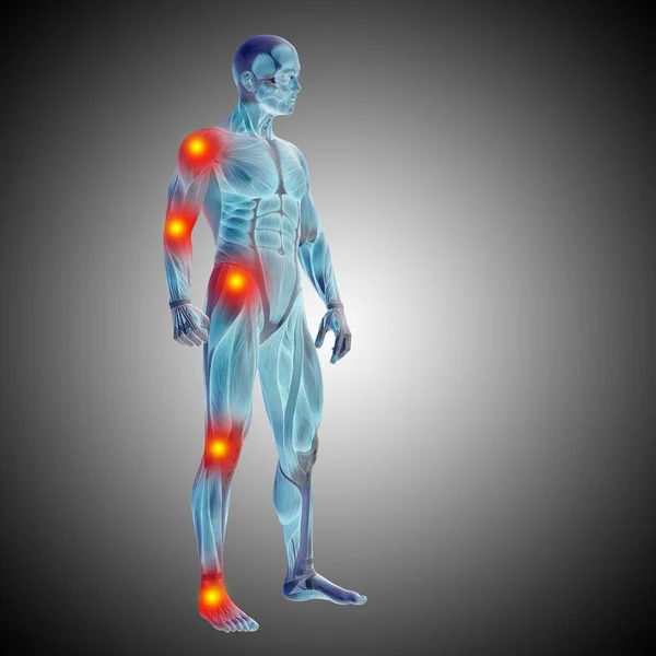 Nsan Anatomisi Vücut Ağrı Enflamasyon Gradyan Arka Planı Gri Ile — Stok fotoğraf