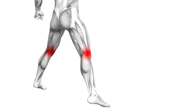 概念性膝关节人体解剖学与红色热点炎症或关节关节疼痛的腿保健治疗或运动肌肉的概念。3d. 图示人关节炎或骨质疏松症 — 图库照片