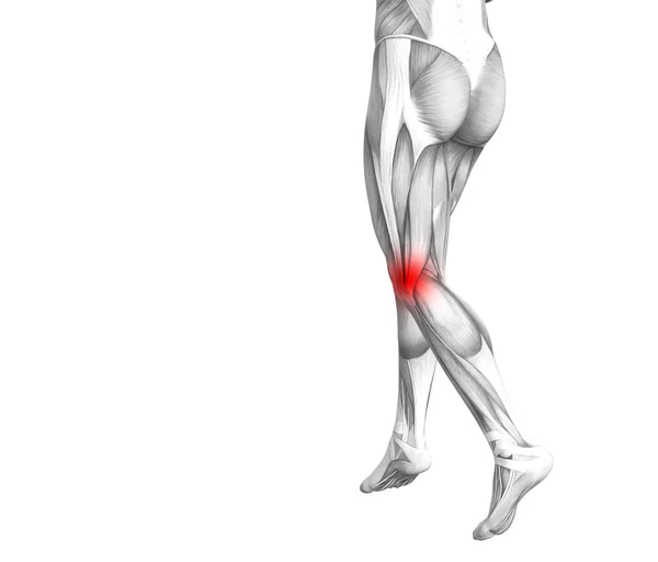 Anatomia człowieka pojęciowy kolana z red hot-spot zapalenie lub stawowej stawów noga opieki zdrowotnej terapii lub sport mięśni pojęć. 3D ilustracja mężczyzna zapalenie stawów lub kości osteoporoza choroby — Zdjęcie stockowe