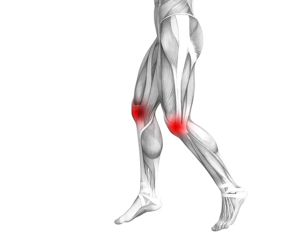 Anatomia humana do joelho conceitual com inflamação do ponto quente vermelho ou dor nas articulações articulares para a terapia de saúde das pernas ou conceitos de músculos esportivos. ilustração 3D homem artrite ou doença da osteoporose óssea — Fotografia de Stock