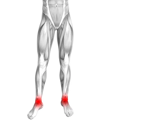 Fogalmi boka emberi anatómia-red hot spot gyulladás vagy izületi ízületi fájdalom a láb egészségügyi kezelés vagy sport izom fogalmak. 3D-s illusztráció az ember arthritis vagy csont csontritkulás betegség — Stock Fotó