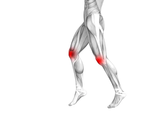 Концептуальная анатомия колена человека с воспалением красной горячей точки или суставной болью в суставах для терапии здоровья ног или концепций спортивных мышц. 3D иллюстрация человека артрит или болезнь костного остеопороза — стоковое фото