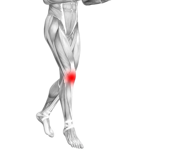 Anatomie conceptuelle du genou humain avec inflammation des points chauds rouges ou douleurs articulaires articulaires pour la thérapie des soins de santé des jambes ou des concepts de muscle sportif. Illustration 3D homme arthrite ou ostéoporose osseuse — Photo