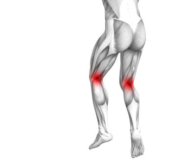 Kırmızı sıcak nokta iltihap veya bacak sağlık tedavi veya spor kas kavramı için Parçalanmõ * eklem ağrısı ile kavramsal diz insan anatomisi. 3D çizim adam artrit veya kemik osteoporoz hastalığı