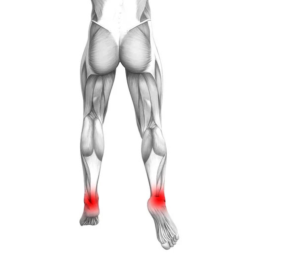 Kavramsal ayak bileği kırmızı sıcak nokta iltihap veya bacak sağlık tedavi veya spor kas kavramı için Parçalanmõ * eklem ağrısı ile insan anatomisi. 3D çizim adam artrit veya kemik osteoporoz hastalığı — Stok fotoğraf