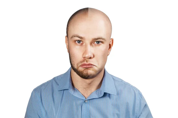 Προσωπογραφία άνθρωπος πριν και μετά την απώλεια μαλλιών, μεταμόσχευση σε απομονωμένο λευκό φόντο. Διχασμένη προσωπικότητα. — Φωτογραφία Αρχείου