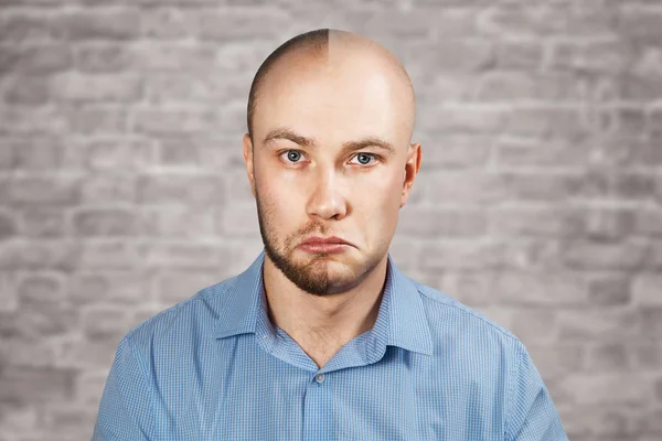 Portret man voor en na haaruitval, transplantatie op bakstenen muur witte achtergrond. Gespleten persoonlijkheid. — Stockfoto