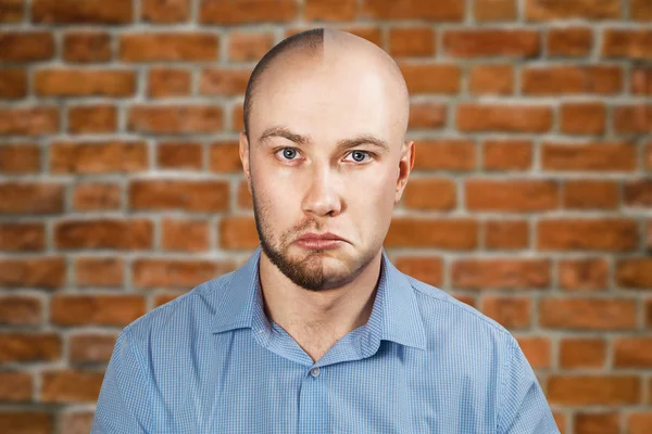 Portret man voor en na haaruitval, transplantatie op bakstenen muur achtergrond. Gespleten persoonlijkheid. — Stockfoto