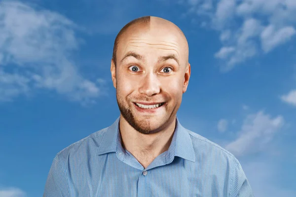 Retrato Homem antes e depois da perda de cabelo, transplante em fundo céu azul. Personalidade dividida . — Fotografia de Stock